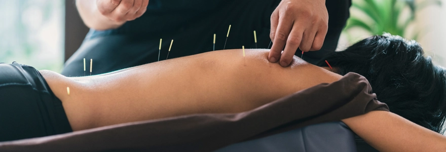 @acupuncture